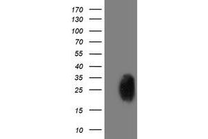 Western Blotting (WB) image for anti-phosphoglycerate Mutase 2 (Muscle) (PGAM2) antibody (ABIN1500173) (PGAM2 抗体)