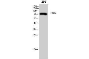 Western Blotting (WB) image for anti-Eukaryotic Translation Initiation Factor 2-alpha Kinase 2 (EIF2AK2) (Thr394) antibody (ABIN3186491) (EIF2AK2 抗体  (Thr394))
