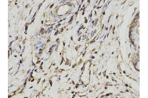 Immunohistochemistry (IHC) image for anti-Proteasome (Prosome, Macropain) Activator Subunit 1 (PA28 Alpha) (PSME1) antibody (ABIN1876546) (PSME1 抗体)