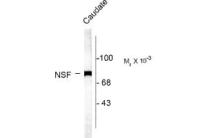 Western blots of rat caudate lysate showing specific labeling of the ~75k NSF protein. (NSF 抗体  (C-Term))