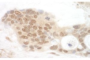 anti-Anaphase Promoting Complex Subunit 7 (ANAPC7) (AA 515-565) antibody