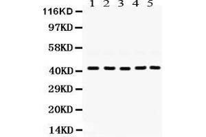 Western Blotting (WB) image for anti-Guanine Nucleotide Binding Protein (G Protein), Q Polypeptide (GNAQ) (AA 102-138), (N-Term) antibody (ABIN3043833) (GNAQ 抗体  (N-Term))