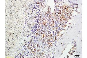 Formalin-fixed and paraffin embedded mouse foot tumor labeled with Anti-? (MSH alpha (AA 138-150) 抗体)