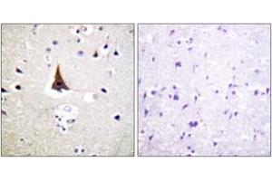 Immunohistochemistry (IHC) image for anti-Vav 2 Guanine Nucleotide Exchange Factor (VAV2) (AA 108-157) antibody (ABIN2888936) (VAV2 抗体  (AA 108-157))