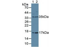 Rabbit Capture antibody from the kit in WB with Positive Control: Human placenta tissue. (Ki-67 ELISA 试剂盒)