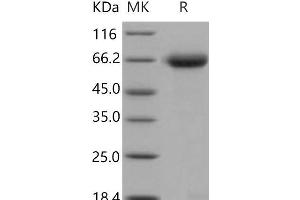 RTN4R Protein (His tag)