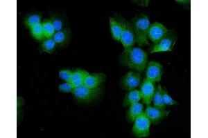 IF analysis of Aldolase/ALDOA using anti- Aldolase/ALDOA antibody (ABIN7601907). (ALDOA 抗体  (AA 50-364))