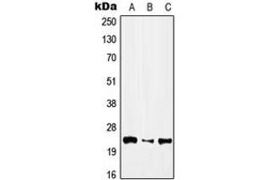 Western blot analysis of IFN alpha 1 expression in HEK293T (A), NIH3T3 (B), H9C2 (C) whole cell lysates. (IFNA1 抗体  (Center))