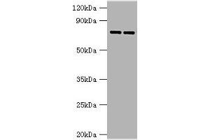 Western blot All lanes: AGUSB antibody at 2 μg/mL Lane 1: HL60 whole cell lysate Lane 2: HepG2 whole cell lysate Secondary Goat polyclonal to rabbit IgG at 1/10000 dilution Predicted band size: 75, 70, 59 kDa Observed band size: 75 kDa (Glucuronidase beta 抗体  (AA 382-651))