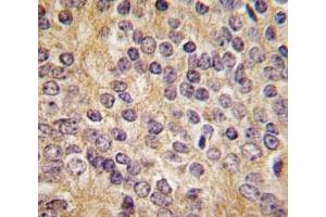 Immunohistochemistry (IHC) image for anti-Plasminogen Activator, Urokinase (PLAU) (AA 396-426) antibody (ABIN3032244)