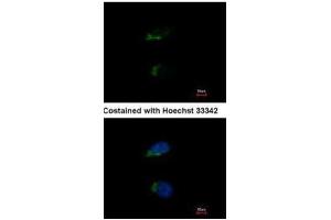 ICC/IF Image Immunofluorescence analysis of methanol-fixed HeLa, using JIK, antibody at 1:500 dilution. (TAO Kinase 3 抗体)