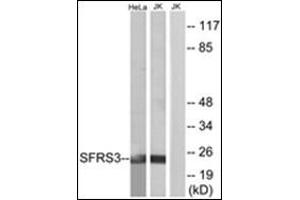 Western blot analysis of extracts from HeLa/Jurkat cells, using SFRS3 Antibody. (SRSF3 抗体  (C-Term))