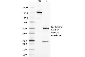 SDS-PAGE Analysis Purified EpCAM Mouse Monoclonal Antibody (EGP40/1798).