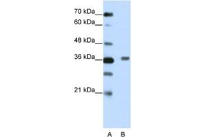 WB Suggested Anti-BTBD6 Antibody Titration:  2. (BTBD6 抗体  (N-Term))