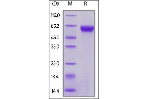 Biotinylated Human / Cynomolgus / Rhesus macaque ROR1, Avitag on  under reducing (R) condition. (ROR1 Protein (AA 30-403) (AVI tag,Biotin))