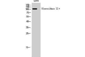 Western Blotting (WB) image for anti-Glucosidase, Alpha, Neutral AB (GANAB) (Internal Region) antibody (ABIN3184803) (GANAB 抗体  (Internal Region))