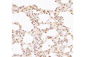 Immunohistochemistry of paraffin embedded rat lung using WDR13 (ABIN7076212) at dilution of 1: 2500 (400x lens) (WDR13 抗体)