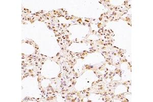 Immunohistochemistry of paraffin embedded rat lung using WDR13 (ABIN7076212) at dilution of 1: 2500 (400x lens) (WDR13 抗体)