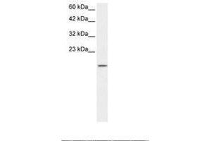 Image no. 1 for anti-Zinc Finger Protein 7 (ZNF7) (AA 62-111) antibody (ABIN202870) (ZNF7 抗体  (AA 62-111))
