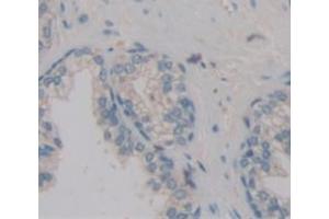 Used in DAB staining on fromalin fixed paraffin- embedded Kidney tissue (POTEG 抗体  (AA 177-330))