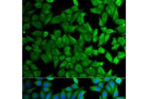 Immunofluorescence analysis of HeLa cells using KLKB1 Polyclonal Antibody (KLKB1 抗体)