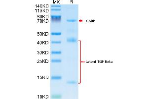 Mouse GARP&Latent TGF beta Complex on Tris-Bis PAGE under reduced condition.