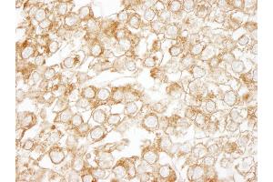 anti-Epidermal Growth Factor Receptor Pathway Substrate 15 (EPS15) (AA 575-625) antibody
