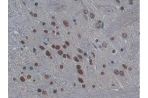 Detection of H3 in Rat Cerebrum Tissue using Polyclonal Antibody to Histone H3 (H3)
