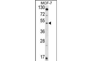 Western blot analysis of HSD11B2 Antibody in MCF-7 cell line lysates (35ug/lane) (HSD11B2 抗体  (AA 277-306))