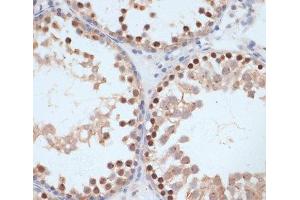 Immunohistochemistry (Paraffin-embedded Sections) (IHC (p)) image for anti-Breast Cancer 1 (BRCA1) (pSer1423) antibody (ABIN7265138)