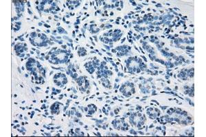 Immunohistochemical staining of paraffin-embedded breast tissue using anti-FH mouse monoclonal antibody. (FH 抗体)