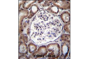 VPS54 Antibody (Center) (ABIN656860 and ABIN2846065) immunohistochemistry analysis in formalin fixed and paraffin embedded human kidney tissue followed by peroxidase conjugation of the secondary antibody and DAB staining. (VPS54 抗体  (AA 465-491))