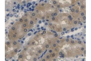 Detection of BLVRA in Rat Kidney Tissue using Polyclonal Antibody to Biliverdin Reductase A (BLVRA) (Biliverdin Reductase 抗体  (AA 10-279))