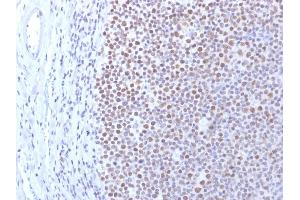 Formalin-fixed, paraffin-embedded human Tonsil stained with DNMT1 Mouse Monoclonal Antibody (DNMT1/2061). (DNMT1 抗体  (AA 767-912))