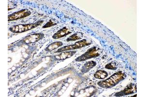 IHC analysis of RanBP1 using anti- RanBP1 antibody . (RANBP1 抗体  (AA 2-201))