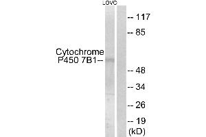 Western blot analysis of extracts from LOVO cells, using Cytochrome P450 7B1 antibody.