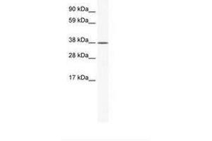 Image no. 1 for anti-Kruppel-Like Factor 2 (Lung) (KLF2) (AA 182-231) antibody (ABIN202326) (KLF2 抗体  (AA 182-231))