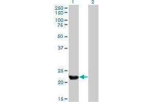 Western Blot analysis of PLDN expression in transfected 293T cell line by PLDN monoclonal antibody (M01), clone 2H8. (Pallidin 抗体  (AA 1-99))