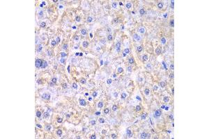 Immunohistochemistry of paraffin-embedded human liver injury using EHHADH antibody (ABIN6292474) at dilution of 1:100 (40x lens). (EHHADH 抗体)