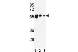 Western blot analysis of anti-beta Tubulin antibody and (1) CEM, (2) MCF-7, and (3) MDA-MB231 lysate.