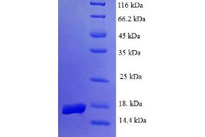 SDS-PAGE (SDS) image for Egl-9 Family Hypoxia Inducible Factor 2 (EGLN2) (AA 283-407), (partial) protein (His tag) (ABIN5709449)