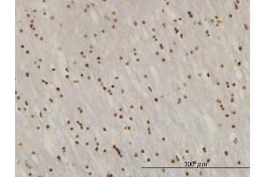 Immunoperoxidase of monoclonal antibody to ZNF313 on formalin-fixed paraffin-embedded human lateral ventricle wall. (RNF114 抗体  (AA 1-228))