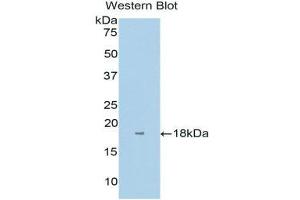 Western Blotting (WB) image for anti-Interleukin 1 Receptor Accessory Protein (IL1RAP) (AA 420-558) antibody (ABIN3202838) (IL1RAP 抗体  (AA 420-558))