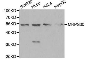 Western blot analysis of extracts of various cell lines, using MRPS30 antibody. (MRPS30 抗体  (AA 190-439))