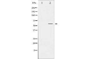 Western blot analysis of PPAR-gamma expression in HuvEc whole cell lysates,The lane on the left is treated with the antigen-specific peptide. (PPARG 抗体  (Internal Region))