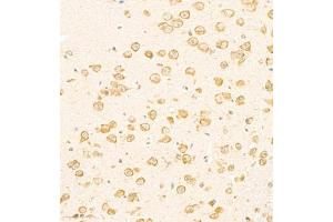 Immunohistochemistry of paraffin embedded mouse brain using SCN4b (ABIN7075646) at dilution of 1:2000 (300x lens) (SCN4B 抗体)
