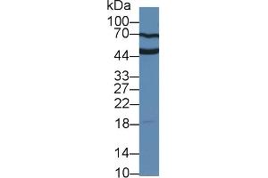 Detection of UPK3A in Human Serum using Polyclonal Antibody to Uroplakin 3A (UPK3A) (Uroplakin 3A 抗体  (AA 15-211))