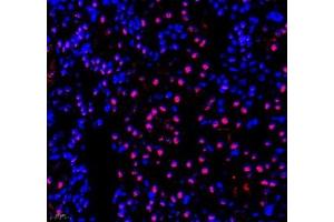 Immunofluorescence of paraffin embedded mouse kidney using PABPN1 (ABIN7075116) at dilution of 1:600 (400x lens) (PABPN1 抗体)