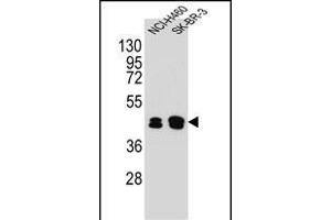 KRT80 Antibody (C-term) (ABIN654828 and ABIN2844502) western blot analysis in NCI-,SK-BR-3 cell line lysates (35 μg/lane). (KRT80 抗体  (C-Term))