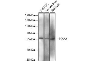 Western blot analysis of extracts of various cell lines, using PDI antibody (ABIN6128422, ABIN6145387, ABIN6145388 and ABIN6216541) at 1:3000 dilution. (PDIA2 抗体  (AA 326-525))